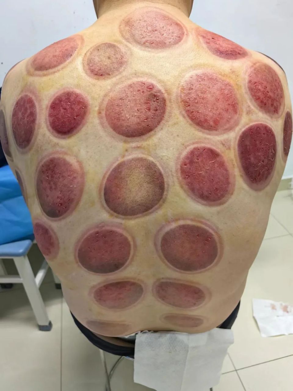 ͼƬ