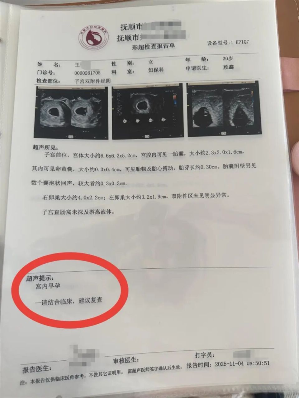 辽宁一孕妇两个月内从一胎变四胞胎，每次产检都发现多出一胎