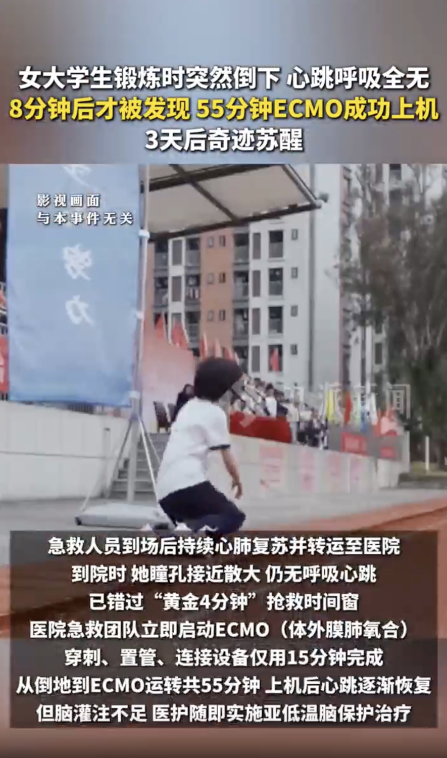 女生为写论文每天仅睡四五小时，锻炼时突然倒地心跳呼吸全无，经15天救治脱离生命危险